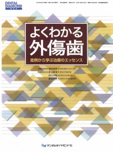 よくわかる外傷歯